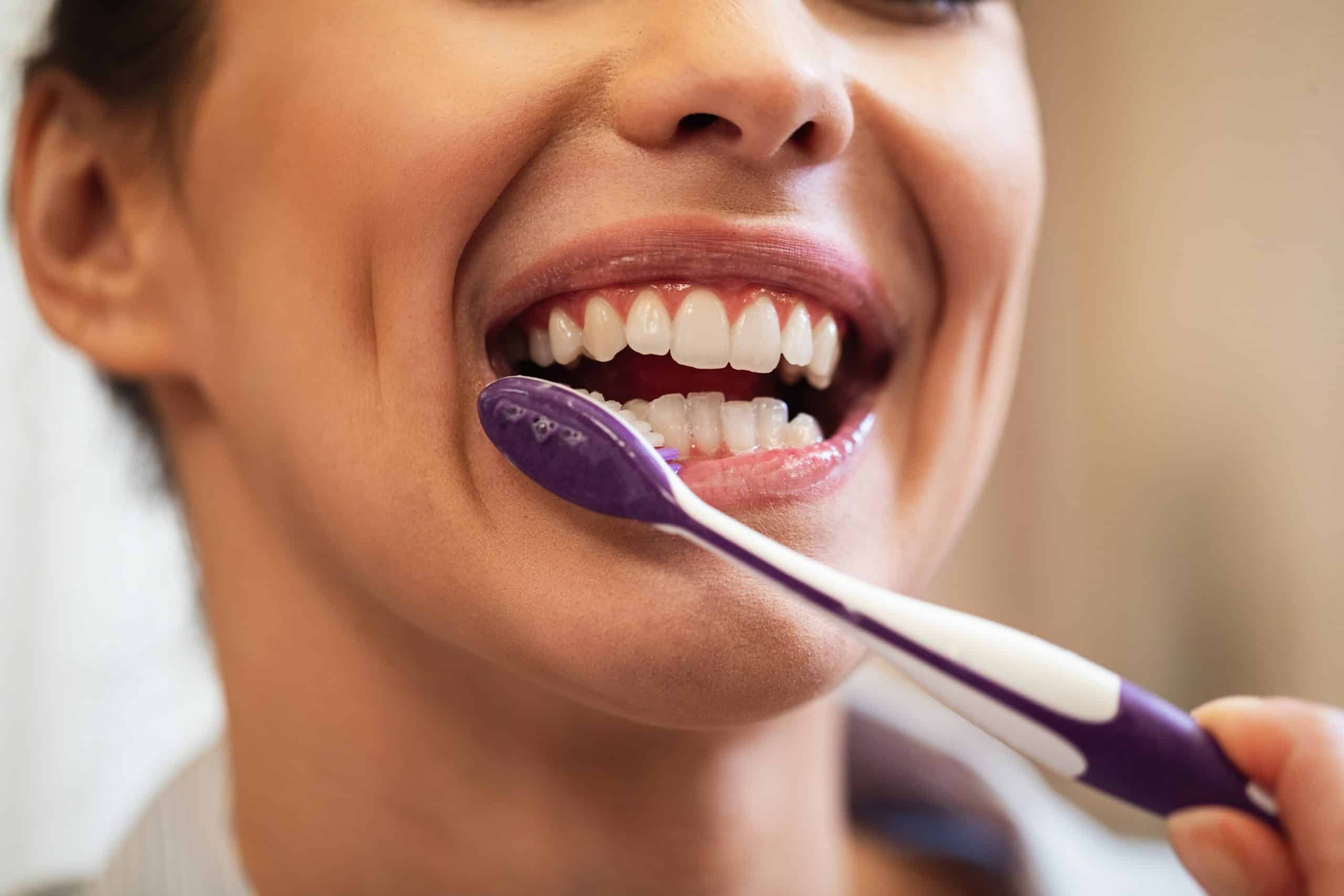Home Teeth Whitening 