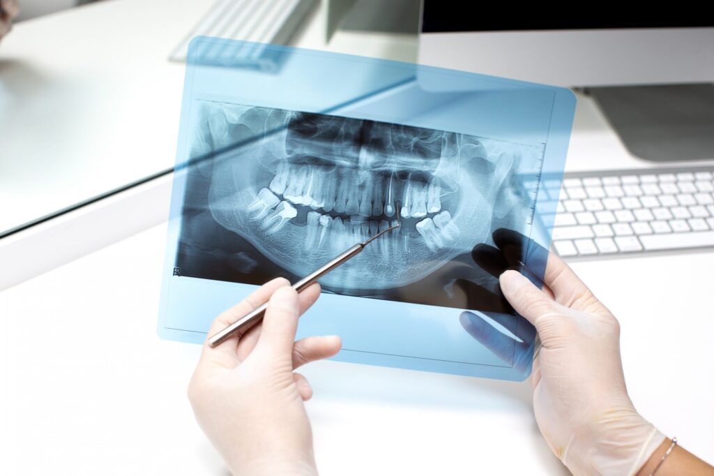 Dentist reviewing a panoramic X-ray, one of the diagnostic services included in CDCP coverage