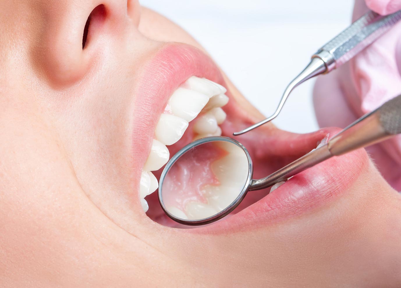 Oral examination