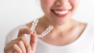 Invisalign in Vancouver