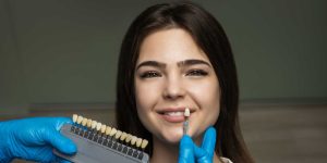 Porcelain Veneers Vancouver