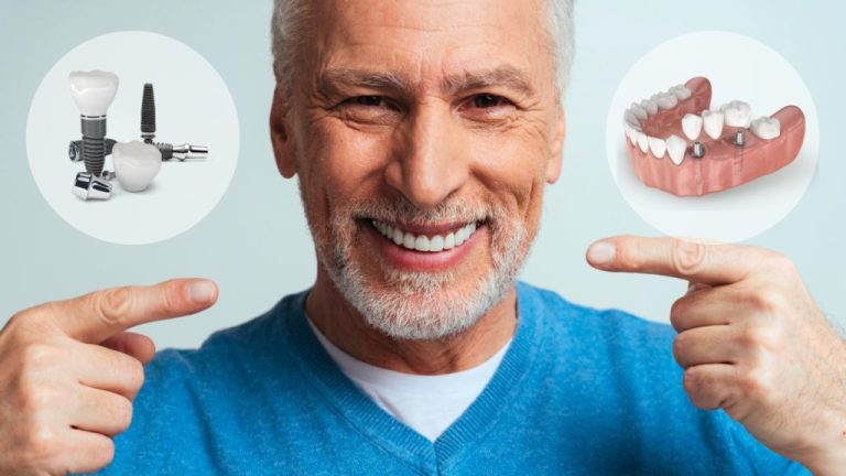 How to Maintain Your Dental Implants For Long-Term Success
