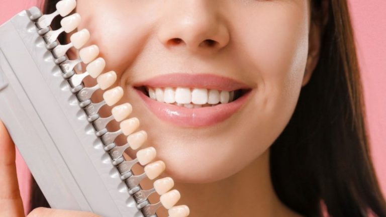 What is Dental Veneers & How It Can Enhance Your Smile