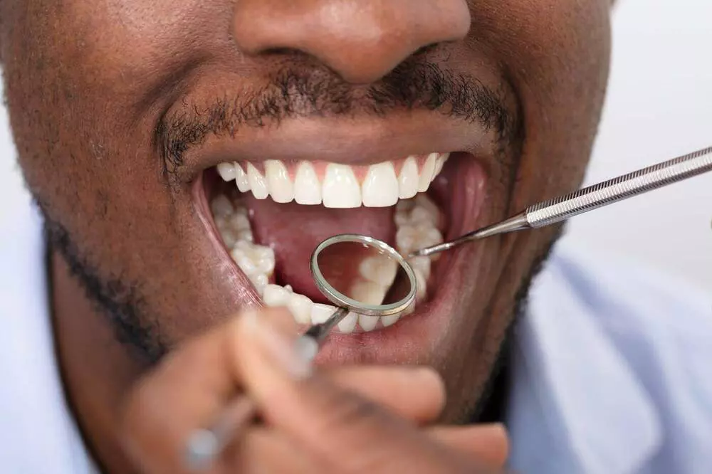 Restorative dentistry treatment